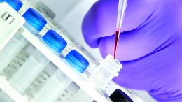 gene expression analysis